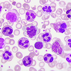 Blood Cancers