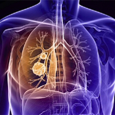 Tumour Specific Sites